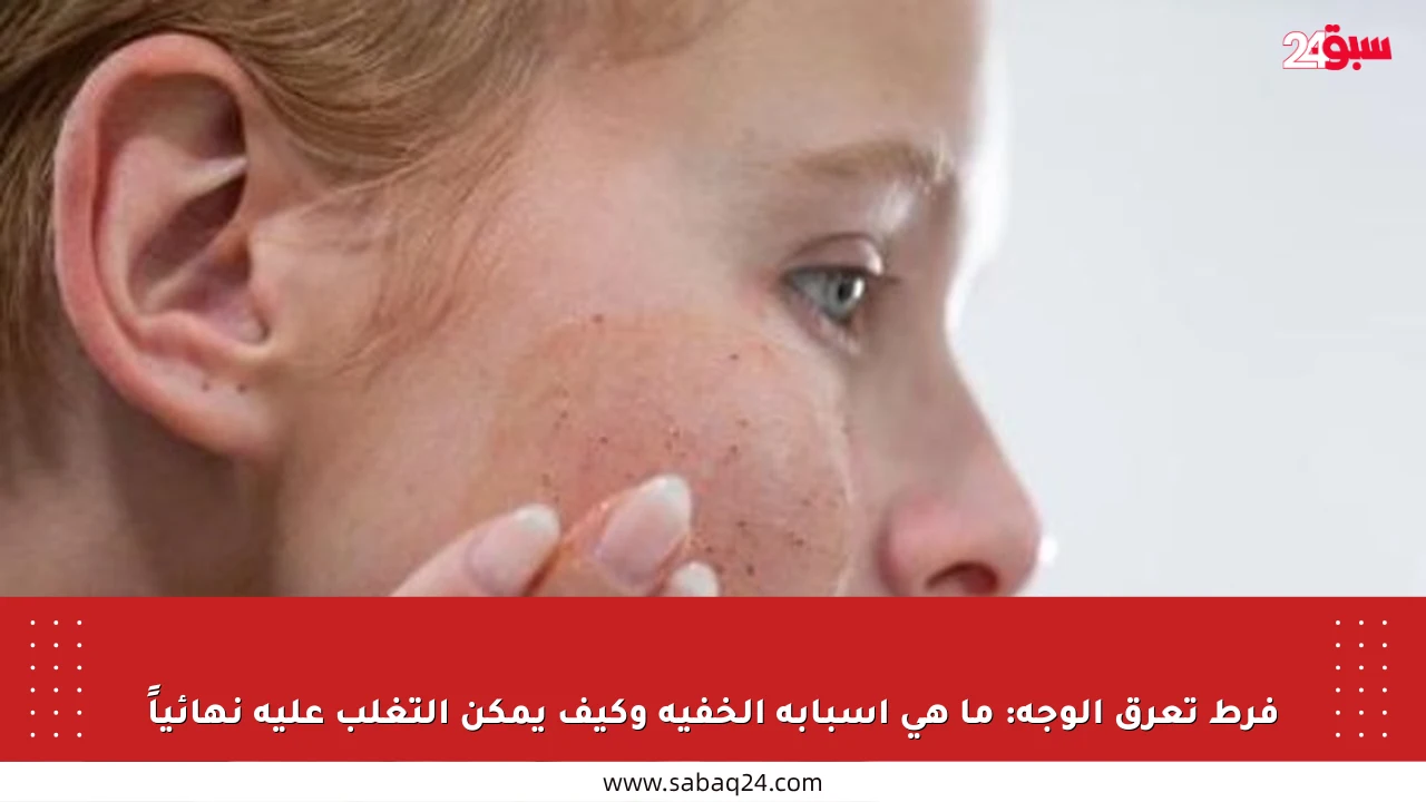 فرط تعرق الوجه: ما هي أسبابه الخفية وكيف يمكن التغلب عليه نهائياً